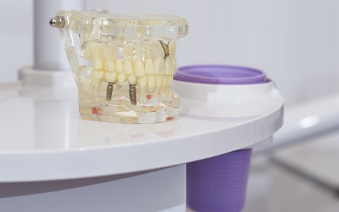 Ingyenes fogászati góckutatás!