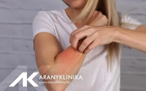 Immunterápia – deszenzibilizálás