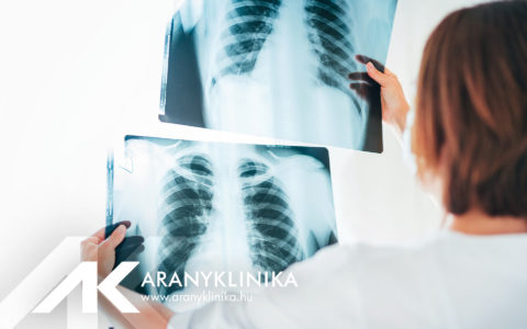 Elérhető Post-COVID tüdőgyógyászati szűrőcsomag az Aranyklinikán!