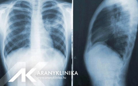 Post-COVID-19 gyermek tüdőgyógyászati szűrőcsomag az Aranyklinikán!