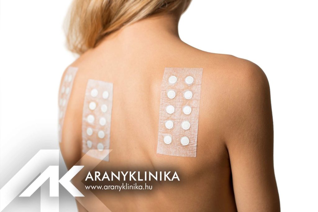 Új Epicutan teszt érhető el az Aranyklinikán!